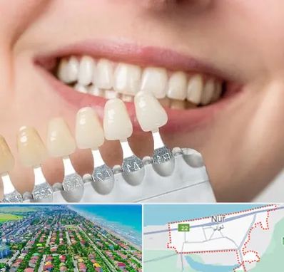 مرکز کامپوزیت دندان در نور