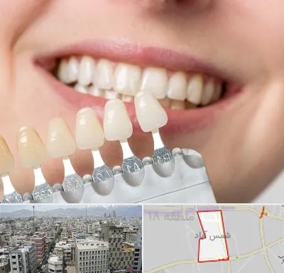 مرکز کامپوزیت دندان در شمس آباد تهران