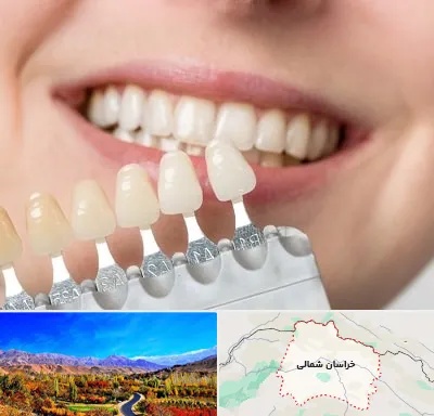 مرکز کامپوزیت دندان در خراسان شمالی