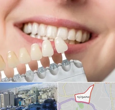 مرکز کامپوزیت دندان در محمودیه