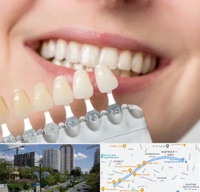 مرکز کامپوزیت دندان در اندرزگو