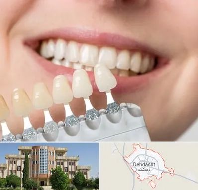 مرکز کامپوزیت دندان در دهدشت