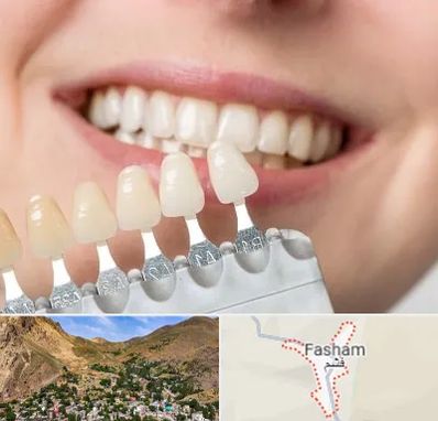 مرکز کامپوزیت دندان در فشم