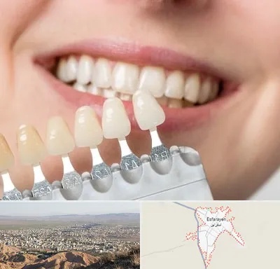 مرکز کامپوزیت دندان در اسفراین