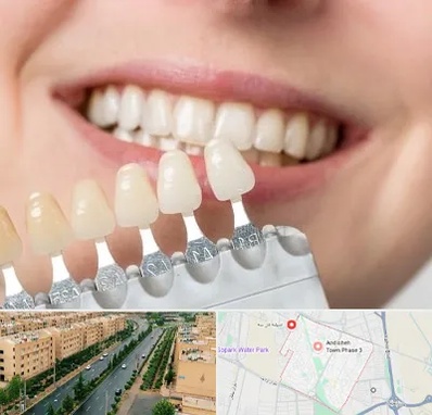 مرکز کامپوزیت دندان در فاز سه اندیشه
