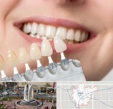 مرکز کامپوزیت دندان در زابل