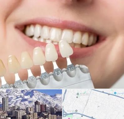 مرکز کامپوزیت دندان در ازگل