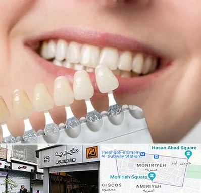 مرکز کامپوزیت دندان در منیریه
