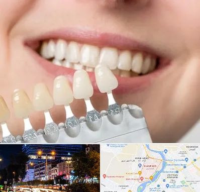 مرکز کامپوزیت دندان در کیانپارس اهواز