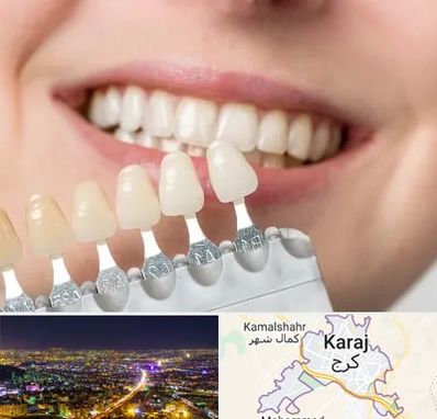 مرکز کامپوزیت دندان در کرج