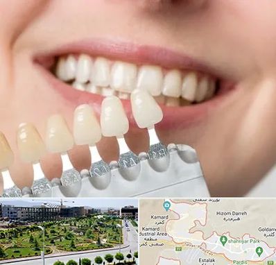 مرکز کامپوزیت دندان در پردیس