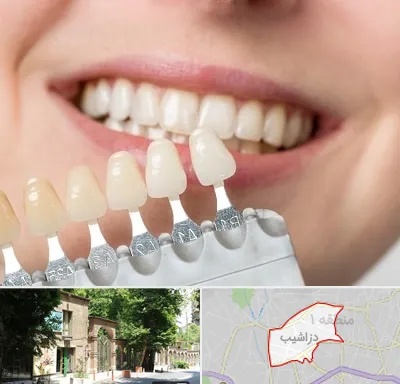 مرکز کامپوزیت دندان در دزاشیب