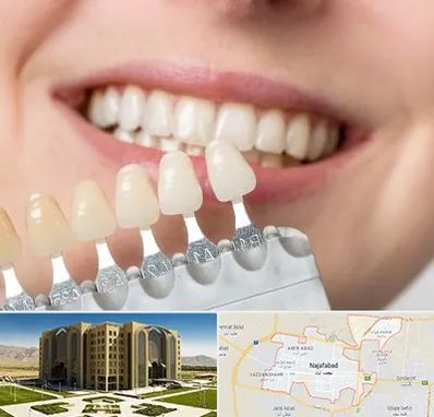 مرکز کامپوزیت دندان در نجف آباد