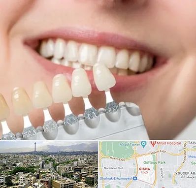 مرکز کامپوزیت دندان در گیشا