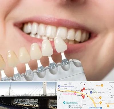 مرکز کامپوزیت دندان در پارک وی