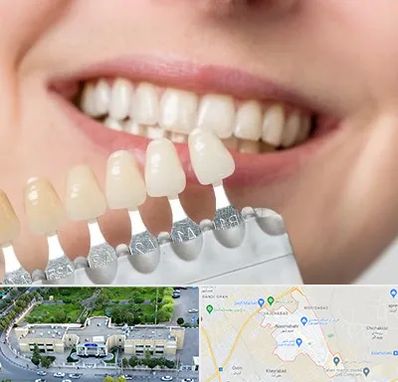 مرکز کامپوزیت دندان در نسیم شهر