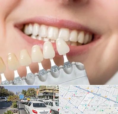 مرکز کامپوزیت دندان در مفتح مشهد