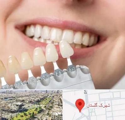 مرکز کامپوزیت دندان در شهرک گلستان