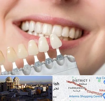 مرکز کامپوزیت دندان در فرمانیه