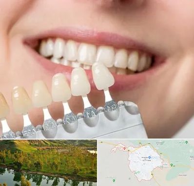 مرکز کامپوزیت دندان در بهبهان