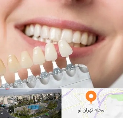 مرکز کامپوزیت دندان در تهران نو