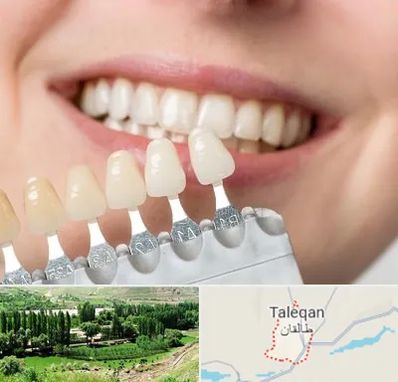مرکز کامپوزیت دندان در طالقان