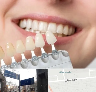 مرکز کامپوزیت دندان در سی متری جی