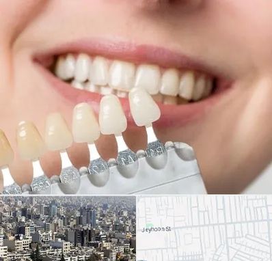 مرکز کامپوزیت دندان در جیحون