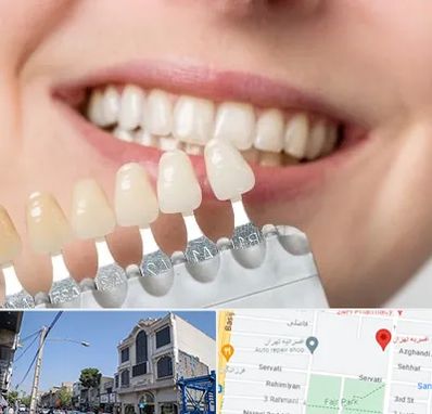 مرکز کامپوزیت دندان در افسریه