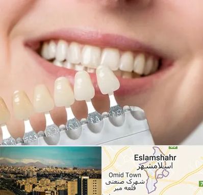 مرکز کامپوزیت دندان در اسلامشهر