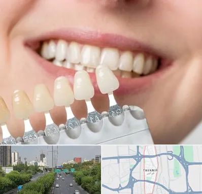 مرکز کامپوزیت دندان در توانیر