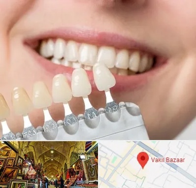 مرکز کامپوزیت دندان در بازار وکیل شیراز