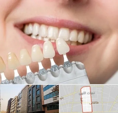 مرکز کامپوزیت دندان در نجات اللهی
