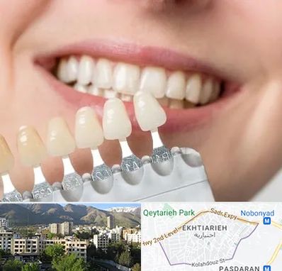 مرکز کامپوزیت دندان در اختیاریه