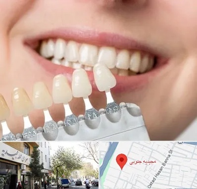 مرکز کامپوزیت دندان در مجیدیه جنوبی