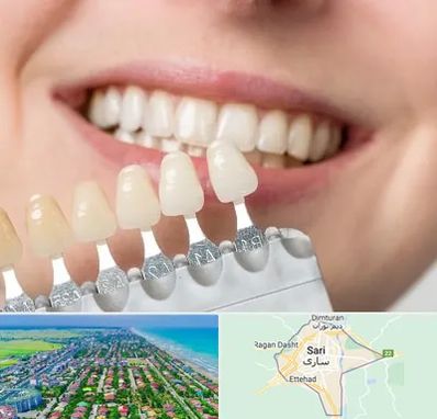 مرکز کامپوزیت دندان در ساری