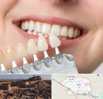 مرکز کامپوزیت دندان در بم