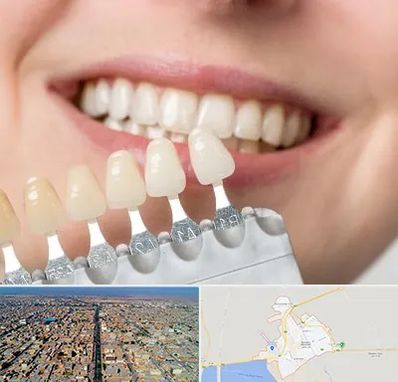 مرکز کامپوزیت دندان در بندر ماهشهر