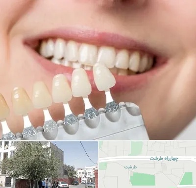 مرکز کامپوزیت دندان در طرشت