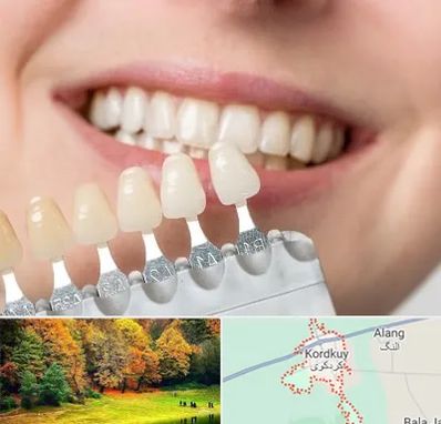 مرکز کامپوزیت دندان در کردکوی