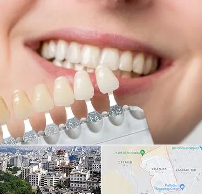 مرکز کامپوزیت دندان در ولنجک