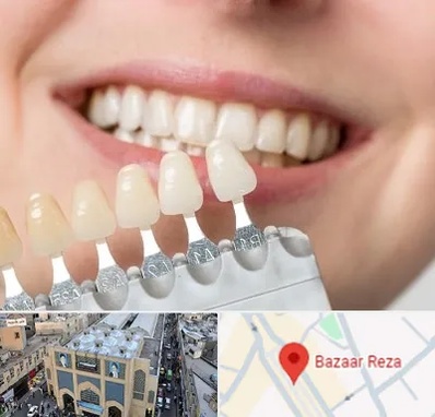 مرکز کامپوزیت دندان در بازار رضا مشهد