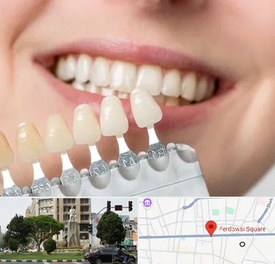 مرکز کامپوزیت دندان در میدان فردوسی تهران
