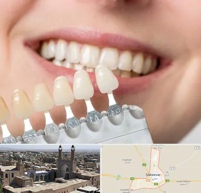 مرکز کامپوزیت دندان در سبزوار