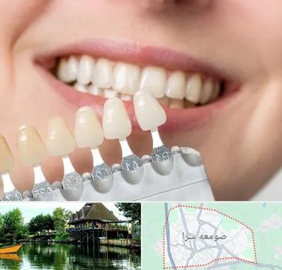 مرکز کامپوزیت دندان در صومعه سرا