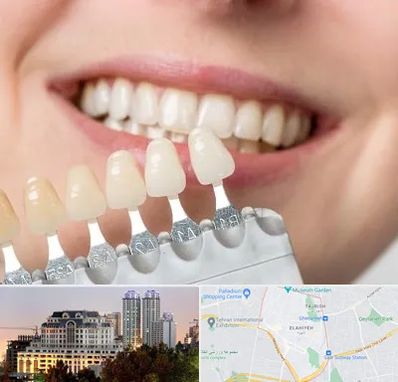 مرکز کامپوزیت دندان در فرشته