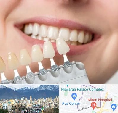 مرکز کامپوزیت دندان در آجودانیه