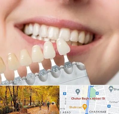 مرکز کامپوزیت دندان در چهارباغ اصفهان