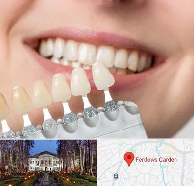 مرکز کامپوزیت دندان در باغ فردوس