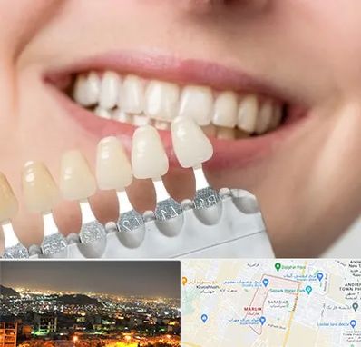 مرکز کامپوزیت دندان در مارلیک کرج